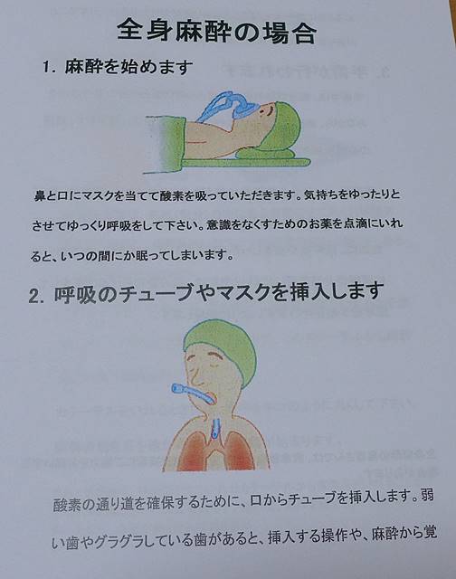 全身麻酔下の手術では気管挿管（酸素を肺へ送るために気管に管を通す作業）も必要になります